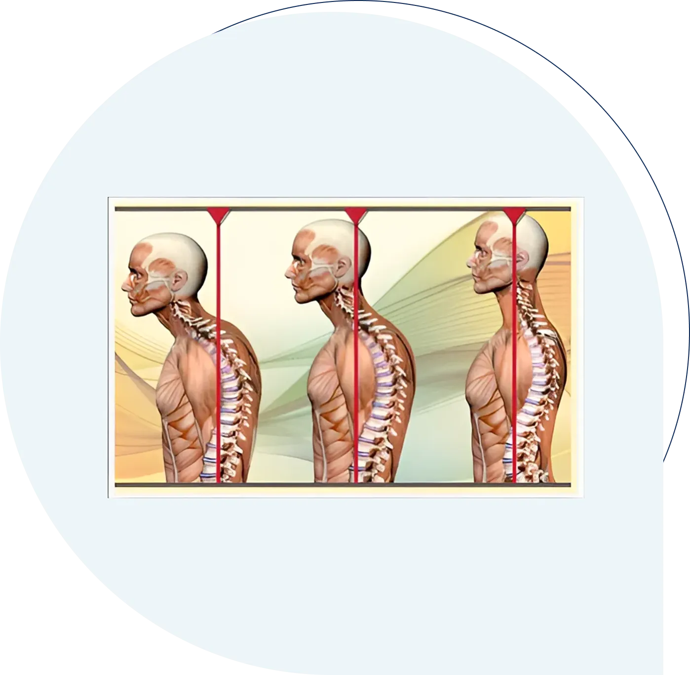 Three postures with different spine alignments.