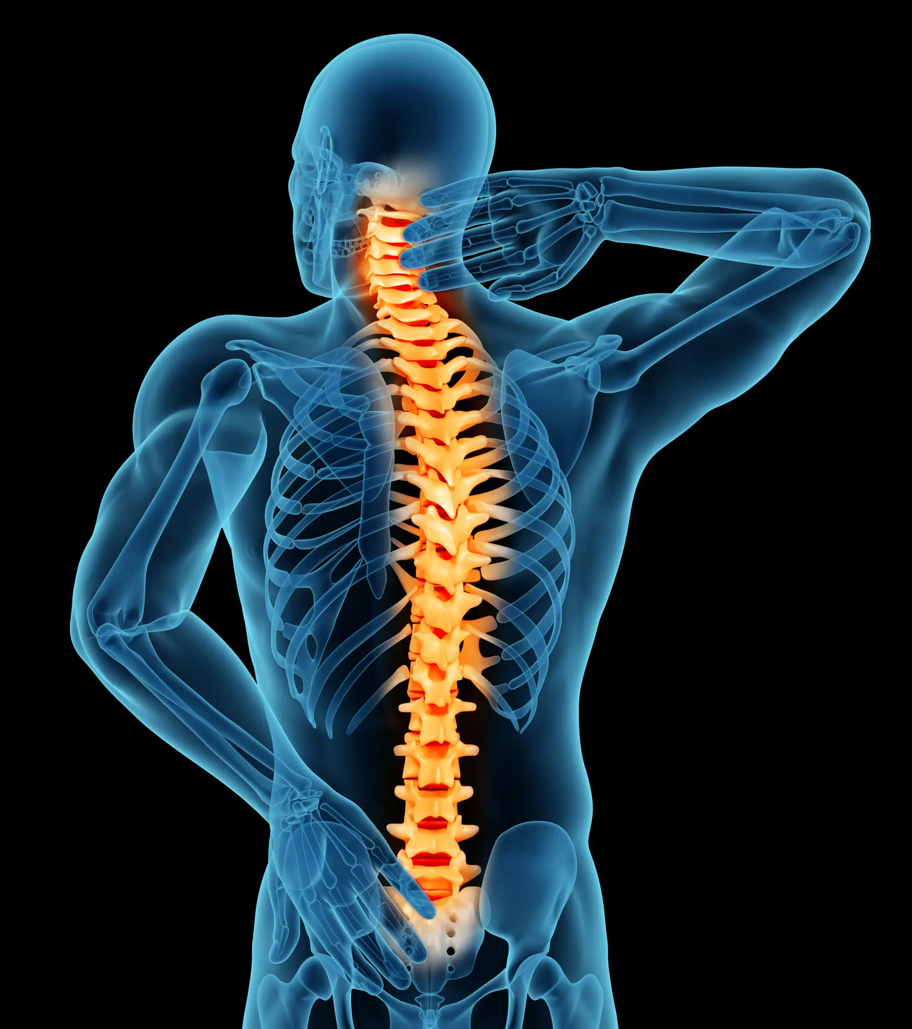 X-ray image highlighting the human spine in orange.